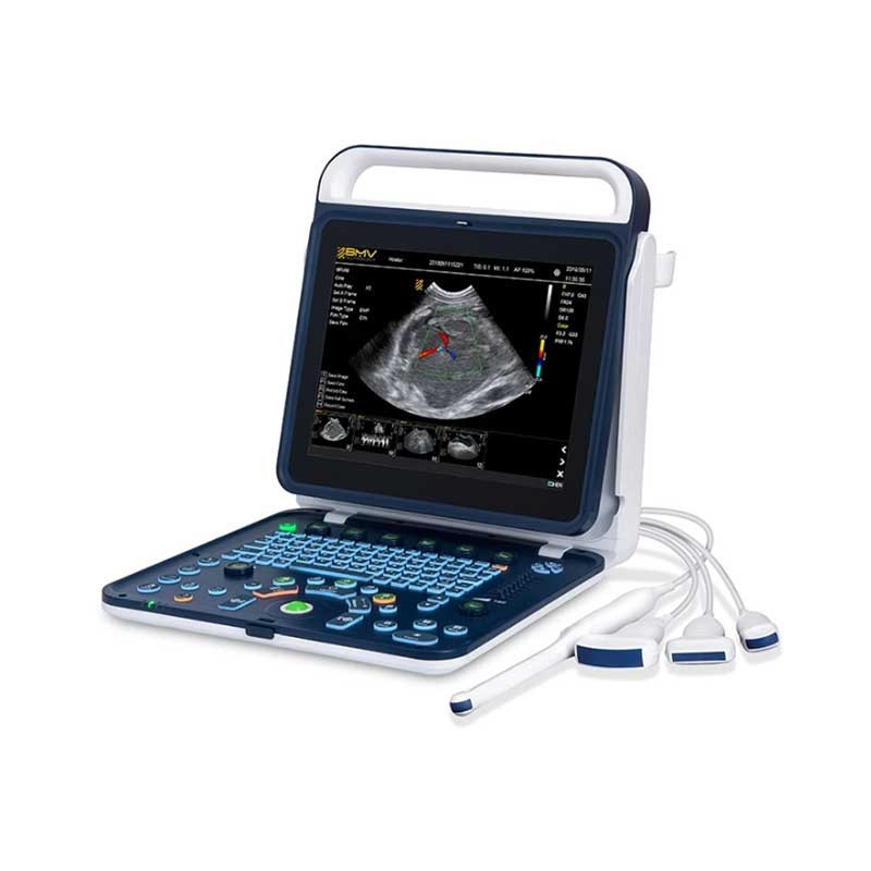 BPU60 portativ rəngli doppler ultrasəs