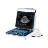 BPU60 portativ rəngli doppler ultrasəs