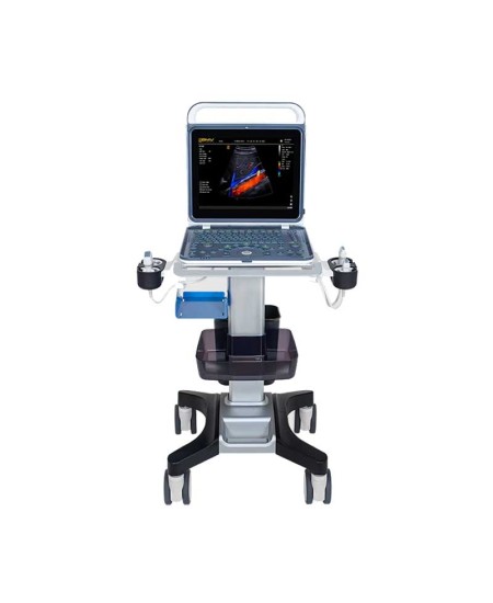 BPU60 portativ rəngli doppler ultrasəs