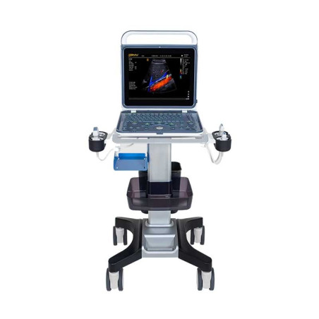 BPU60 portativ rəngli doppler ultrasəs