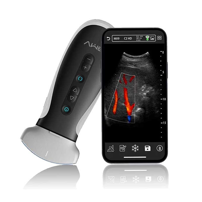 دستگاه سنوگرافی جیبی قدرتمند MX9 دستگاه سنوگرافی جیبی قدرتمند MX9