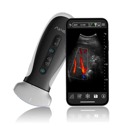 diagnostic equipment