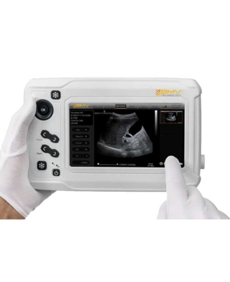 Güclü MX300 ultrasəs texnologiyası