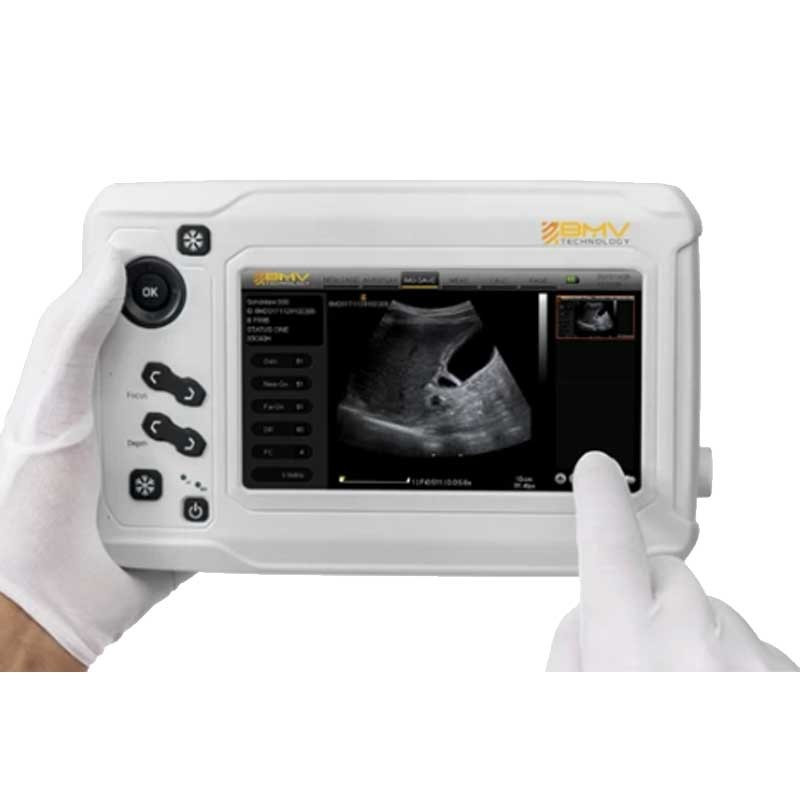 تقنية الموجات فوق الصوتية القوية MX300