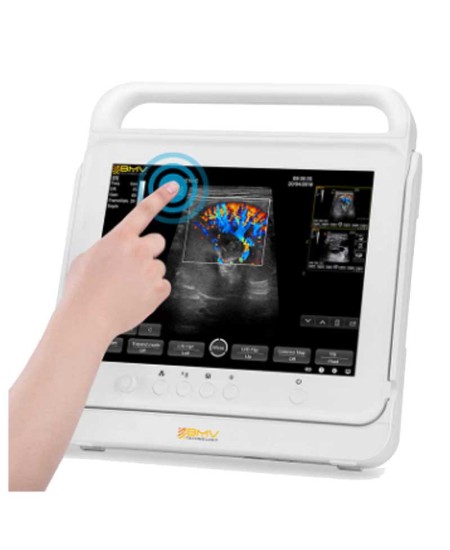 PT50C portativ toxunma rəngli Doppler ultrasəs