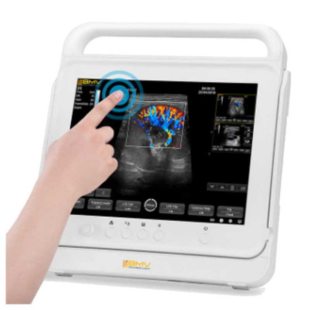 PT50C portativ toxunma rəngli Doppler ultrasəs