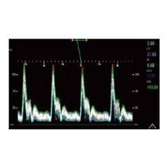 PT50C الموجات فوق الصوتية دوبلر الملونة المحمولة التي تعمل باللمس PT50C الموجات فوق الصوتية دوبلر الملونة المحمولة التي تعمل باللمس