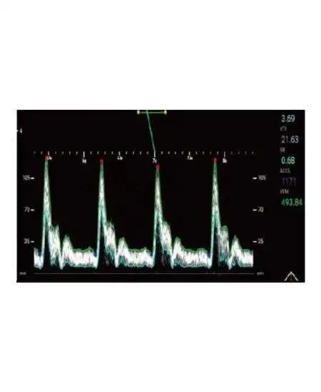 PT50C سونوگرافی داپلر رنگی لمسی قابل حمل