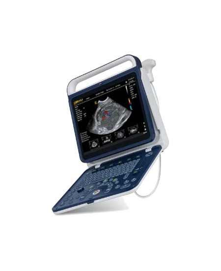 PT60 portable color Doppler ultrasound