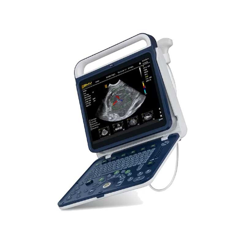PT60 portativ rəngli Doppler ultrasəs