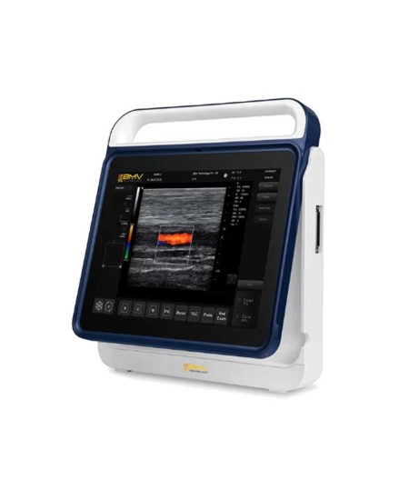 PT60 portable color Doppler ultrasound